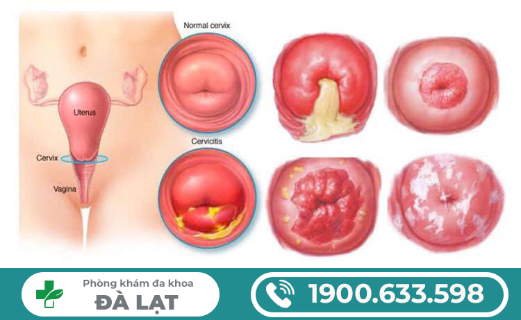 Hình ảnh minh họa